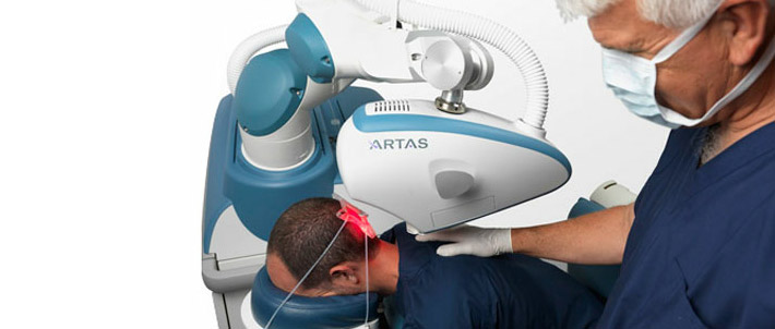 ARTAS Procedure