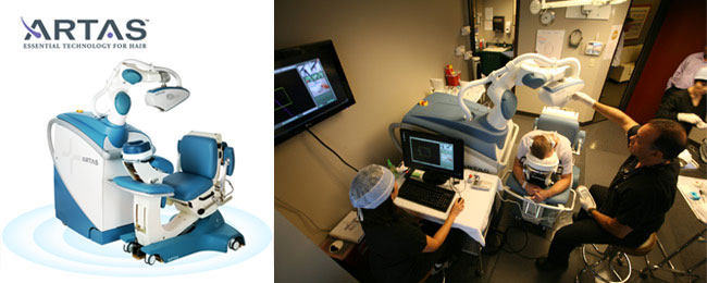 ARTAS - FAQ